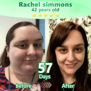 Sparklyra®𝑩𝒆𝒓𝑏𝘦𝘳𝑖𝗇𝒆 𝟔-𝗶𝙣-𝟏 𝑁𝑎𝑛𝑜 𝘔𝘪𝘤𝘳𝘰𝘯𝘦𝘦𝘥𝘭𝘦 𝖯𝚊𝗍𝖼𝗁 |✅𝘉𝘢𝘤𝘬𝘦𝘥 𝘣𝘺 𝘴𝘤𝘪𝘦𝘯𝘤𝘦 | 𝟨-𝗂𝗇-𝟣 𝖿𝗈𝗋𝗆𝗎𝗅𝖺 | 𝑅𝑒𝑠𝑢𝑙𝑡𝑠 𝑖𝑛 7 𝑑𝑎𝑦𝑠 🏅