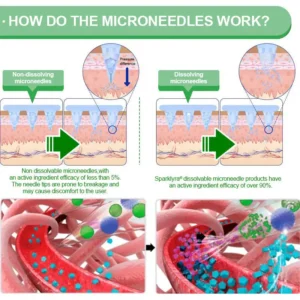 Sparklyra®𝑩𝒆𝒓𝑏𝘦𝘳𝑖𝗇𝒆 𝟔-𝗶𝙣-𝟏 𝑁𝑎𝑛𝑜 𝘔𝘪𝘤𝘳𝘰𝘯𝘦𝘦𝘥𝘭𝘦 𝖯𝚊𝗍𝖼𝗁 |✅𝘉𝘢𝘤𝘬𝘦𝘥 𝘣𝘺 𝘴𝘤𝘪𝘦𝘯𝘤𝘦 | 𝟨-𝗂𝗇-𝟣 𝖿𝗈𝗋𝗆𝗎𝗅𝖺 | 𝑅𝑒𝑠𝑢𝑙𝑡𝑠 𝑖𝑛 7 𝑑𝑎𝑦𝑠 🏅